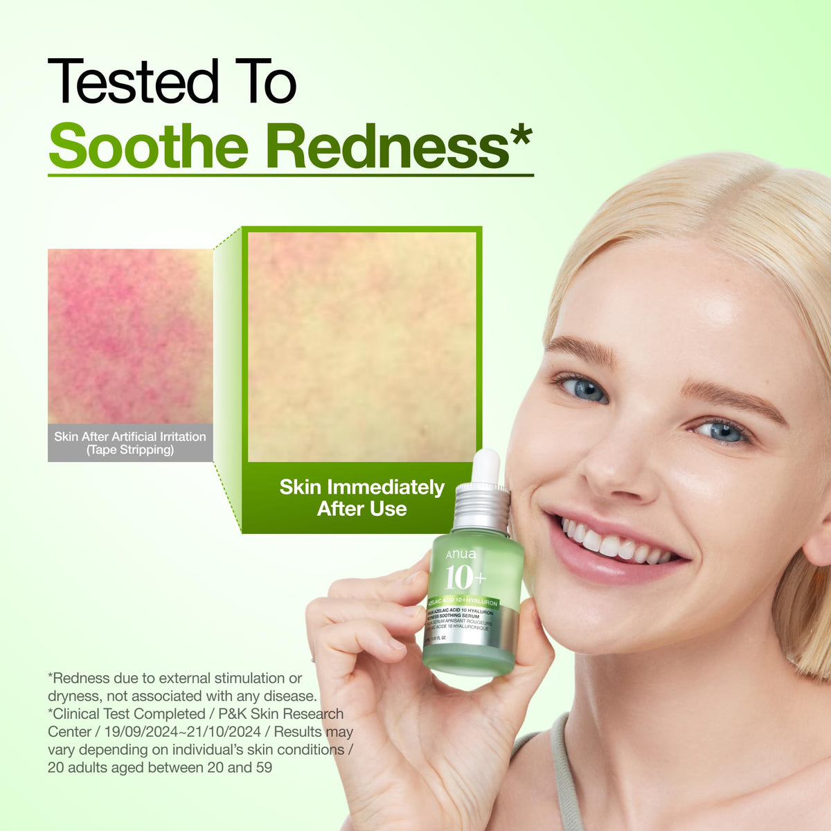 ANUA Azelaic Acid 10 percent lightweight soothing serum texture for redness-prone skin