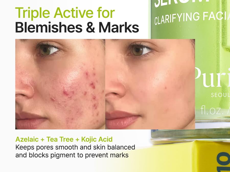 PURITO SEOUL Azelaic Acid 10 Kojic Tea Tree Serum post acne mark out