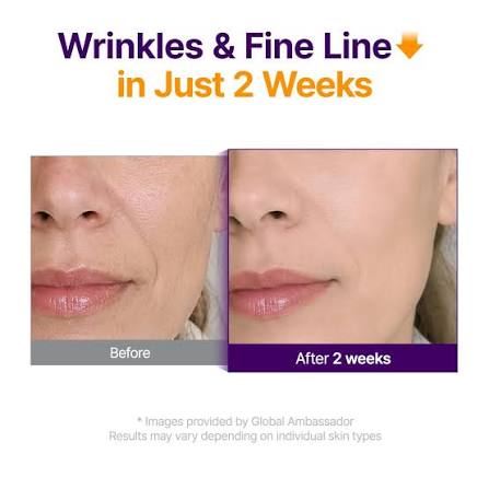 PURITO SEOUL Retinol Retinal 2000 NAD+ Serum wrinkles and fine line before vs after in 2 weeks