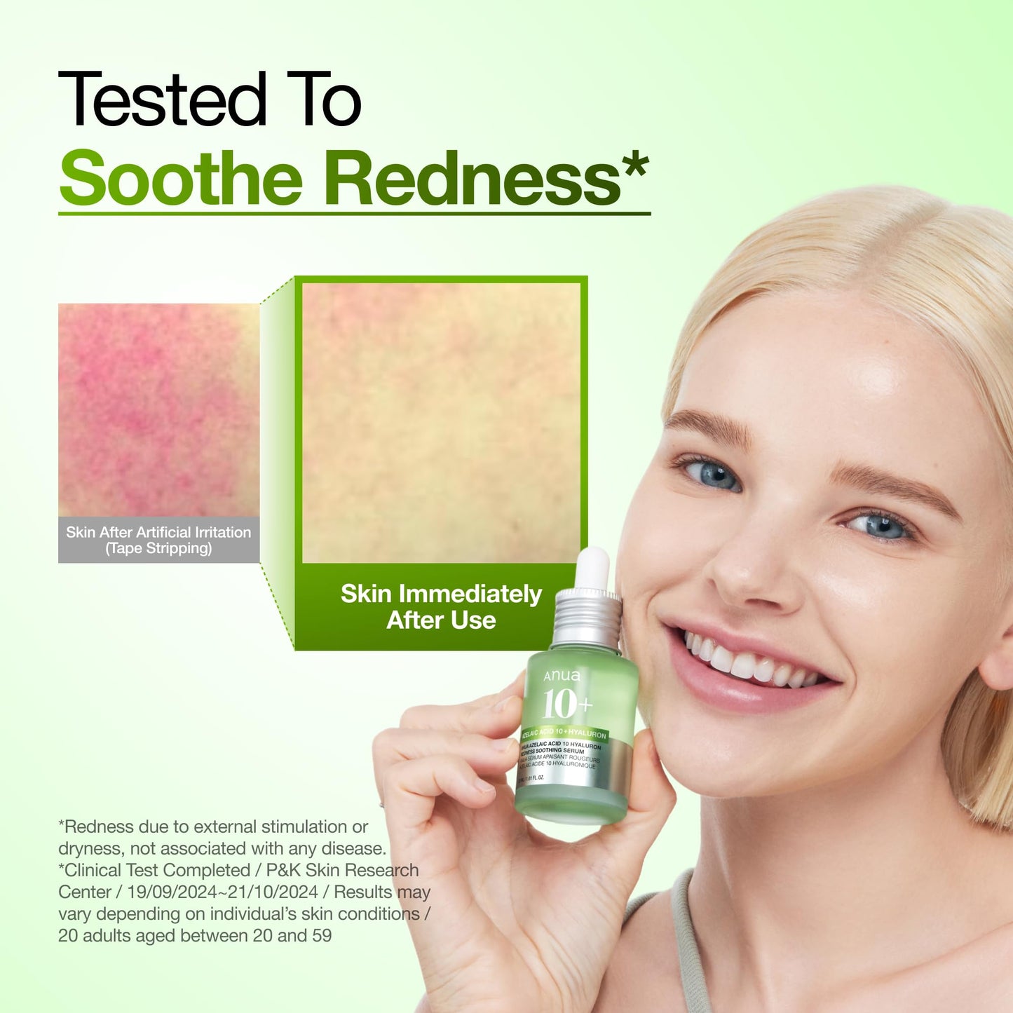 ANUA Azelaic Acid 10 percent lightweight soothing serum texture for redness-prone skin