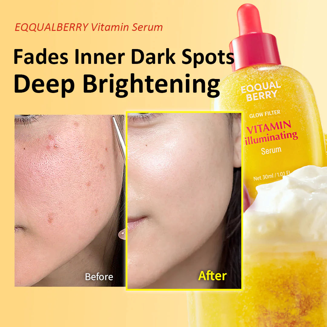EQUALBERRY Vitamin Serum bottle with 'Before' and 'After' skin comparison on a yellow background
