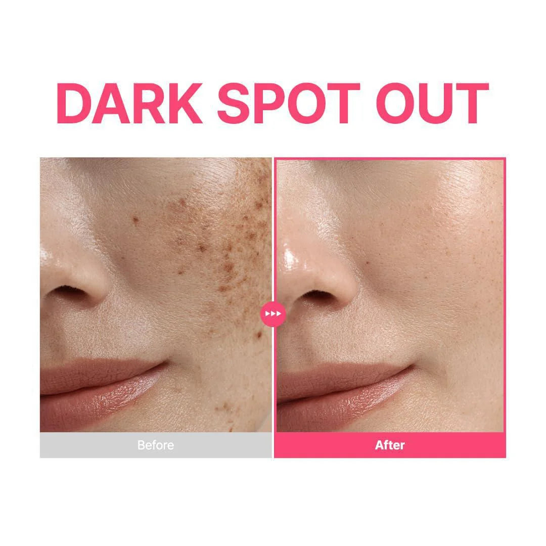 PURITO TXA 6 Niacinamide 10 Retinal Serum capsule Before and after comparison of dark spots on skin